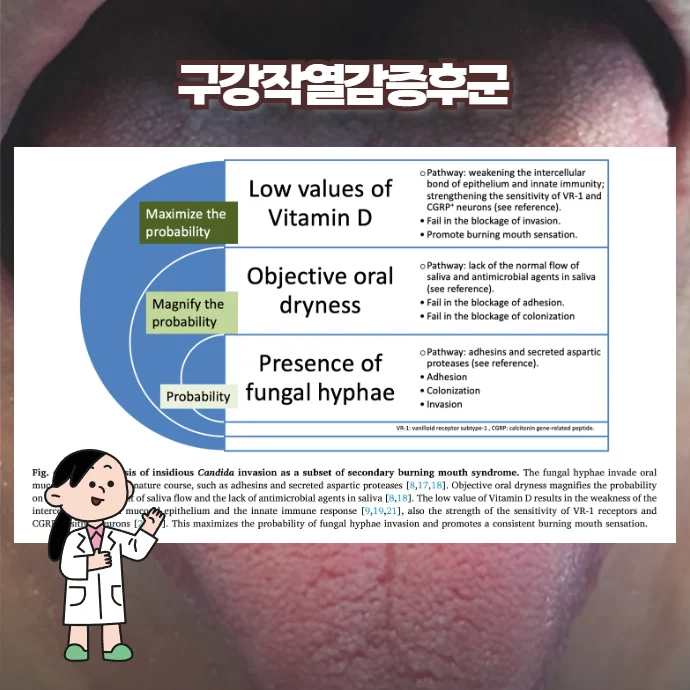 BMS 원인 분류