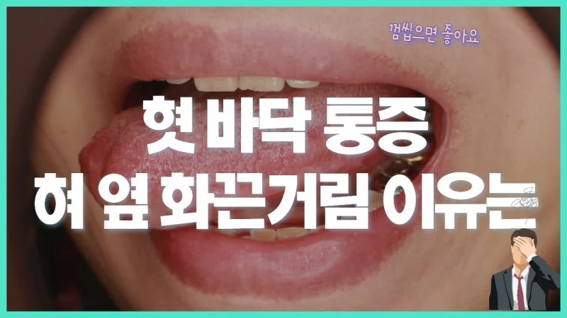 혀 바닥 통증과 BMS