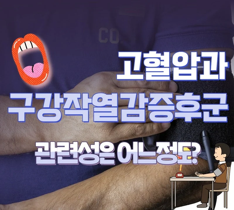 고혈압과 구강작열감증후군의 관련성 — 242명 대상 연구로 본 상관관계