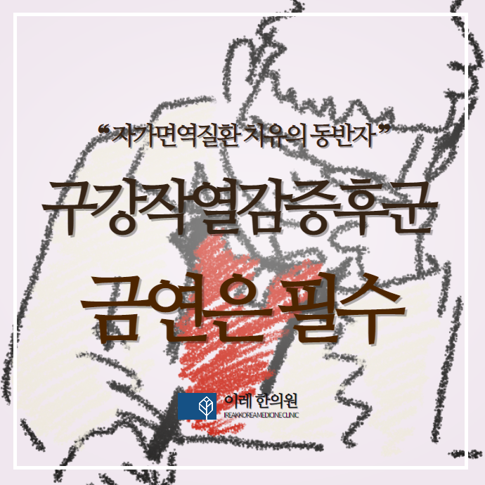 구강작열감증후군과 흡연: 담배가 혀 통증에 미치는 영향은?