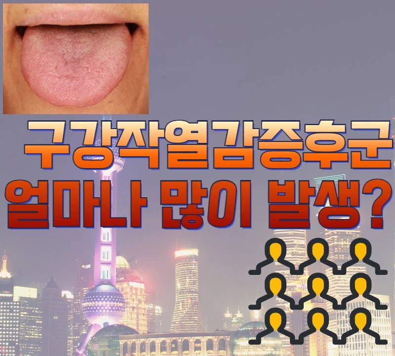 구강작열감증후군 유병률 - 생각보다 흔한 질환입니다