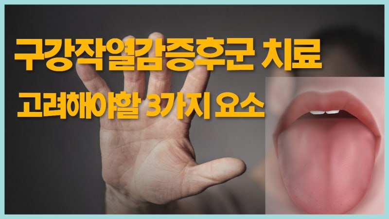 구강작열감증후군 치료 시 반드시 고려해야 할 3가지 — 심리, 면역, 구강 상태