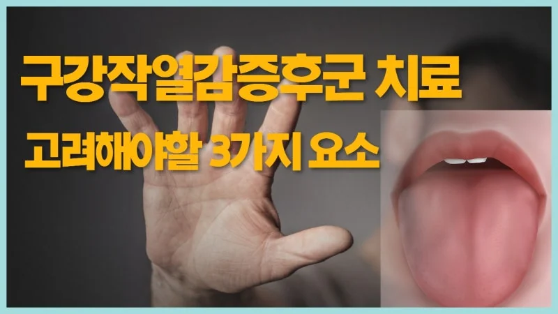 구강작열감증후군 치료 시 반드시 고려해야 할 3가지 — 심리, 면역, 구강 상태