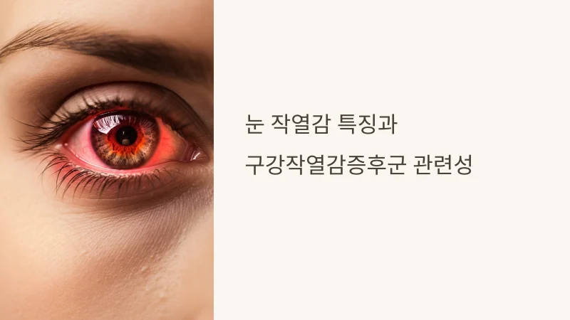 눈 화끈거림과 작열감, 안구건조증이 아닌 Burning Eye Syndrome일 수 있습니다