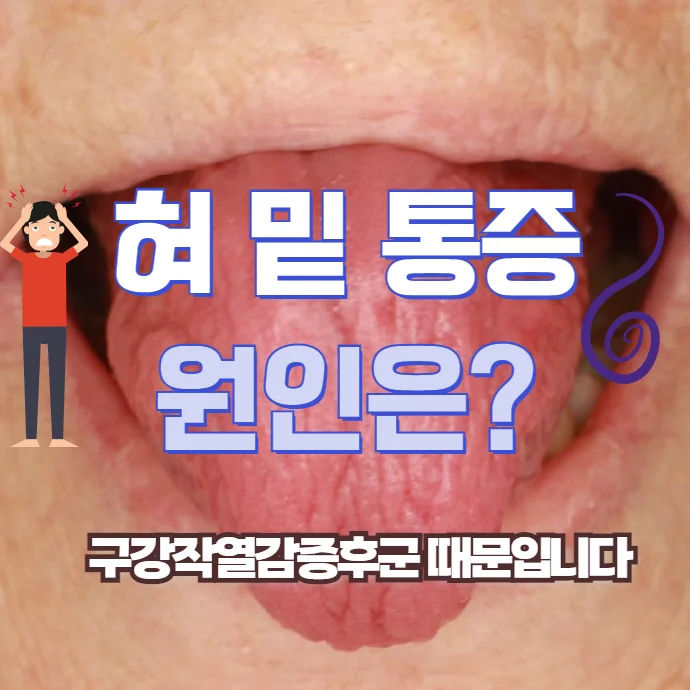 혀 밑 통증 원인 - 스트레스와 불면이 관련된다면 BMS를 의심하세요