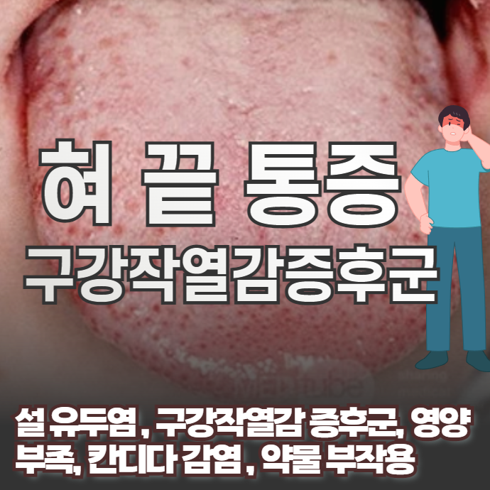 혀끝 통증의 9가지 원인과 약물 부작용으로 인한 구강작열감증후군