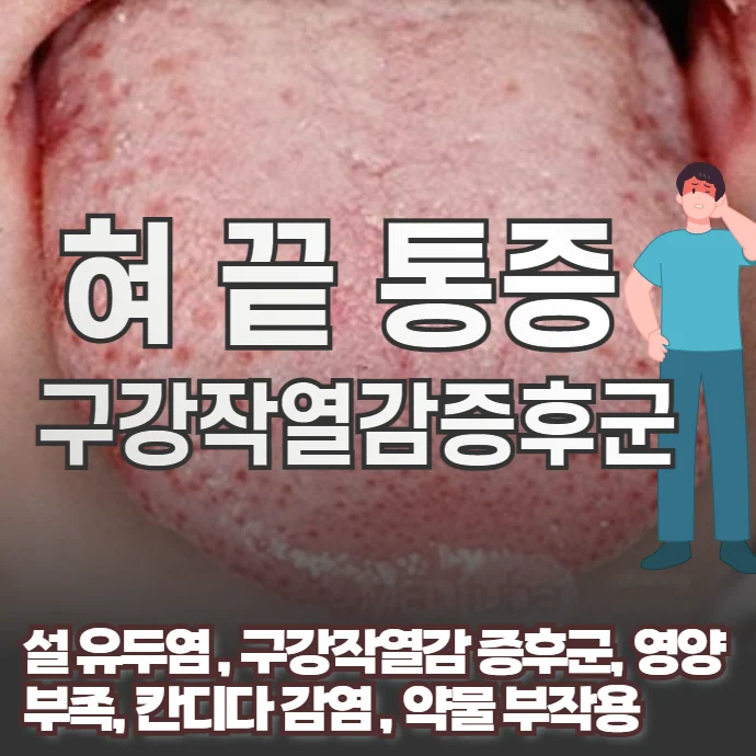 혀끝 통증의 9가지 원인과 약물 부작용으로 인한 구강작열감증후군