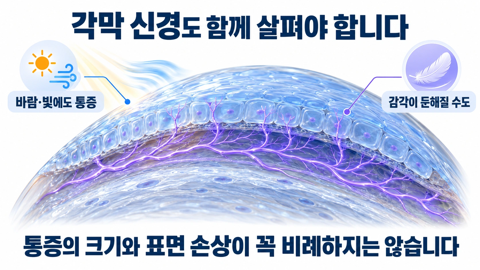 각막상피 주변 감각신경과 바람·빛에 대한 통증 또는 감각 저하 가능성을 설명한 모식도
