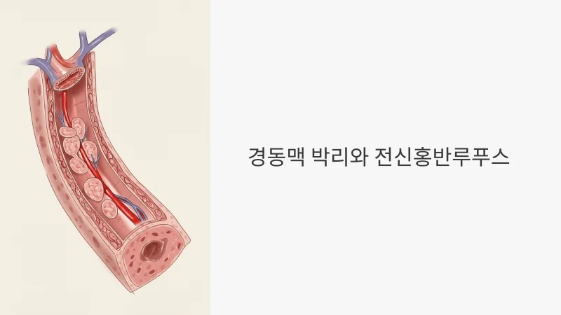 경동맥 박리와 루푸스