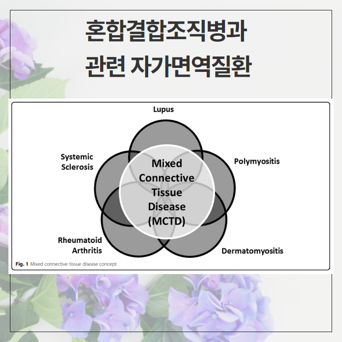 MCTD 진단 기준