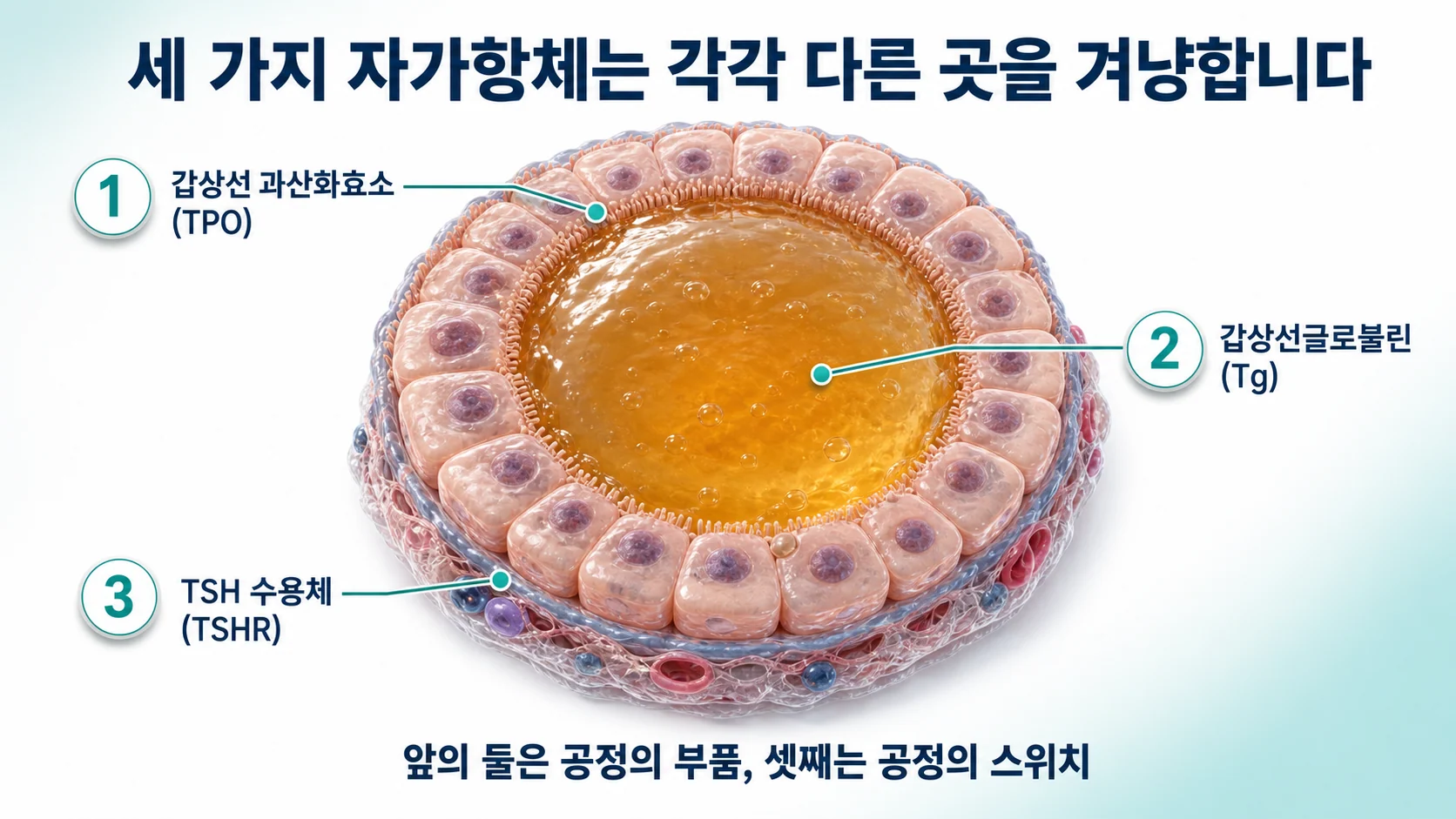 갑상선 여포에서 TPO·Tg·TSH수용체 세 가지 자가항원의 위치를 표시한 개념도