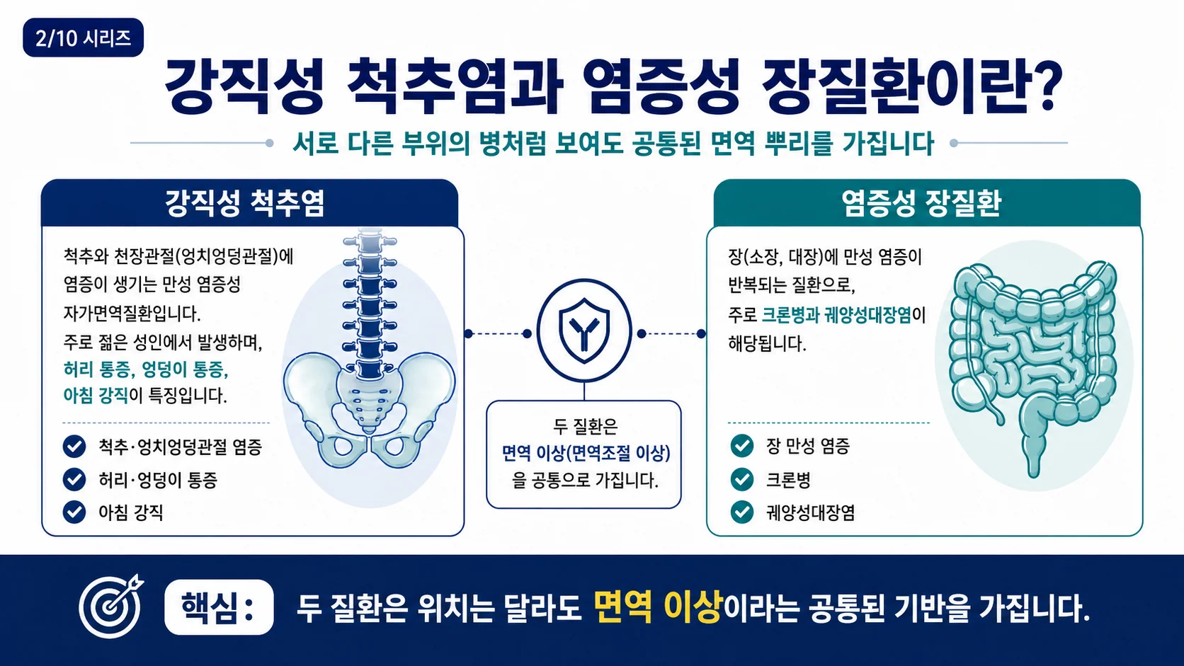 강직성 척추염과 염증성 장질환이란 — 공통된 면역 뿌리