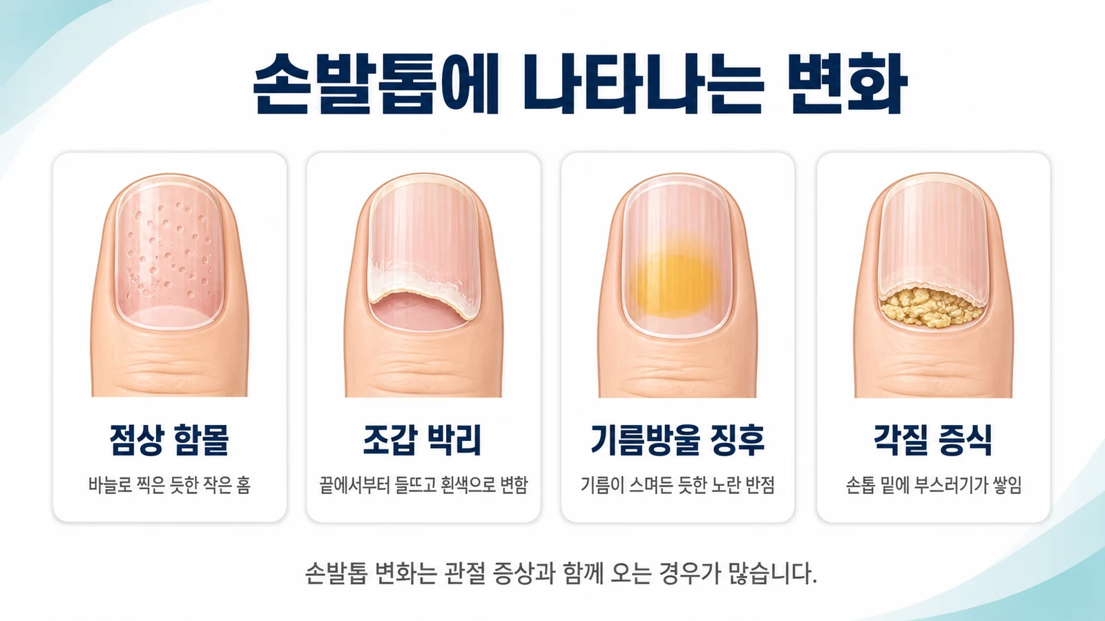 손발톱에서 확인하는 네 가지 변화