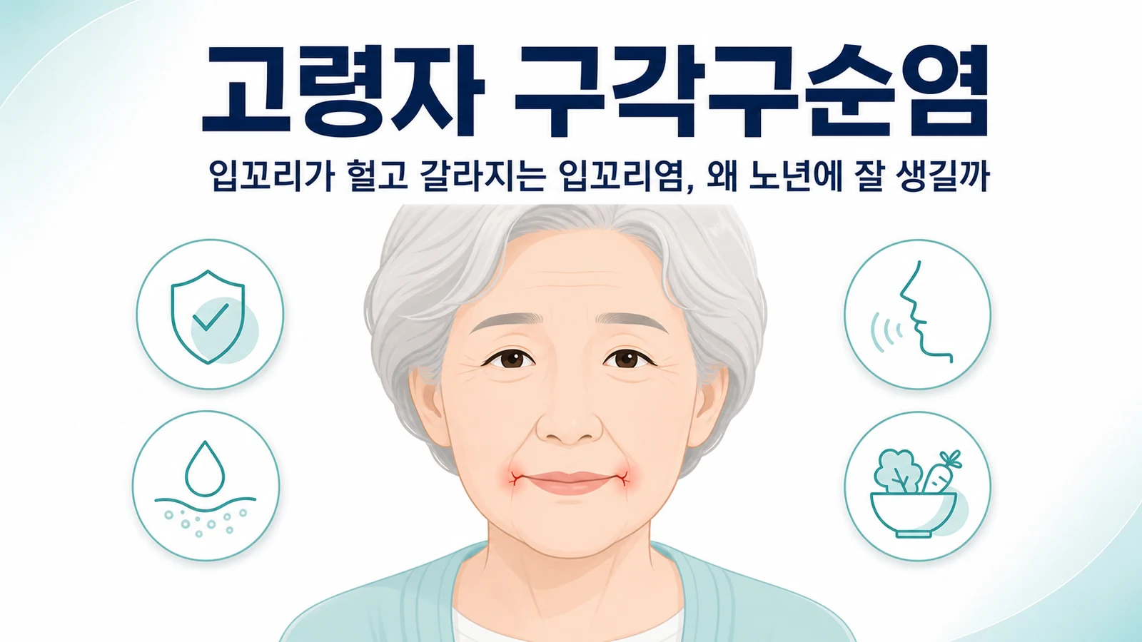 입꼬리가 헐고 갈라지는 고령자 구각구순염을 나타낸 그림