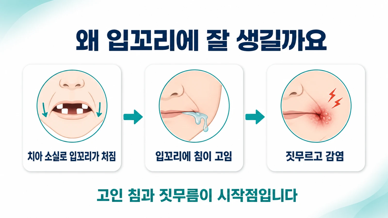 치아 소실로 입꼬리 처짐, 침 고임, 짓무름과 감염으로 이어지는 과정