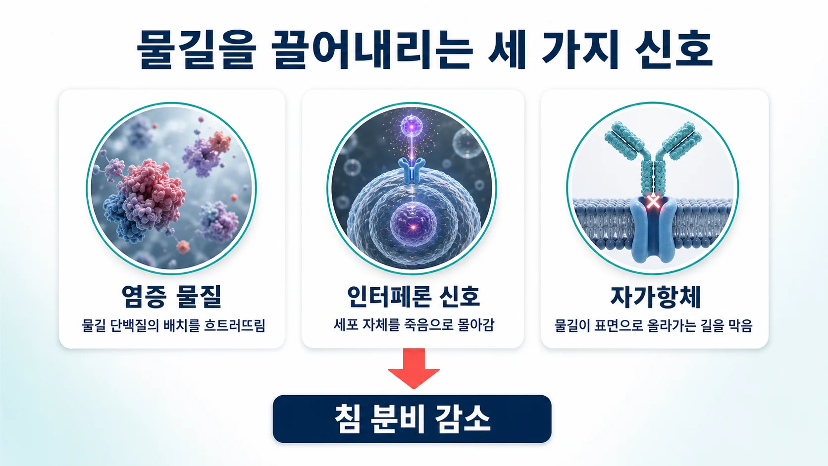 염증 물질과 인터페론 신호, 자가항체가 물길 단백질을 끌어내리는 세 가지 경로를 정리한 도식