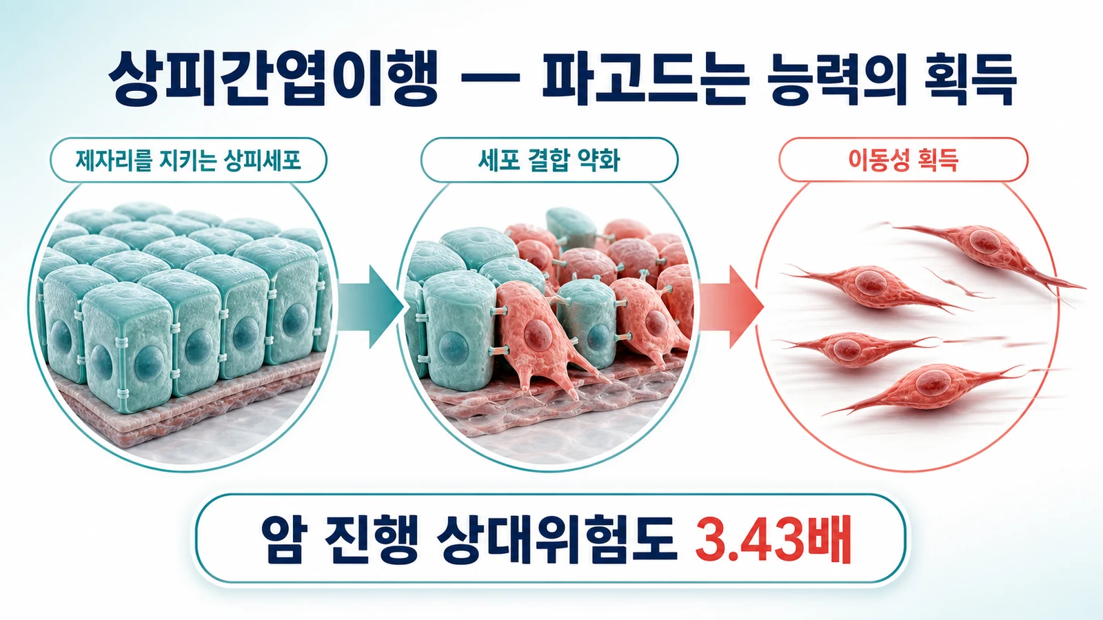 상피세포가 이동성 세포로 성질이 바뀌는 상피간엽이행 과정을 단계별 도식으로 설명한 인포그래픽