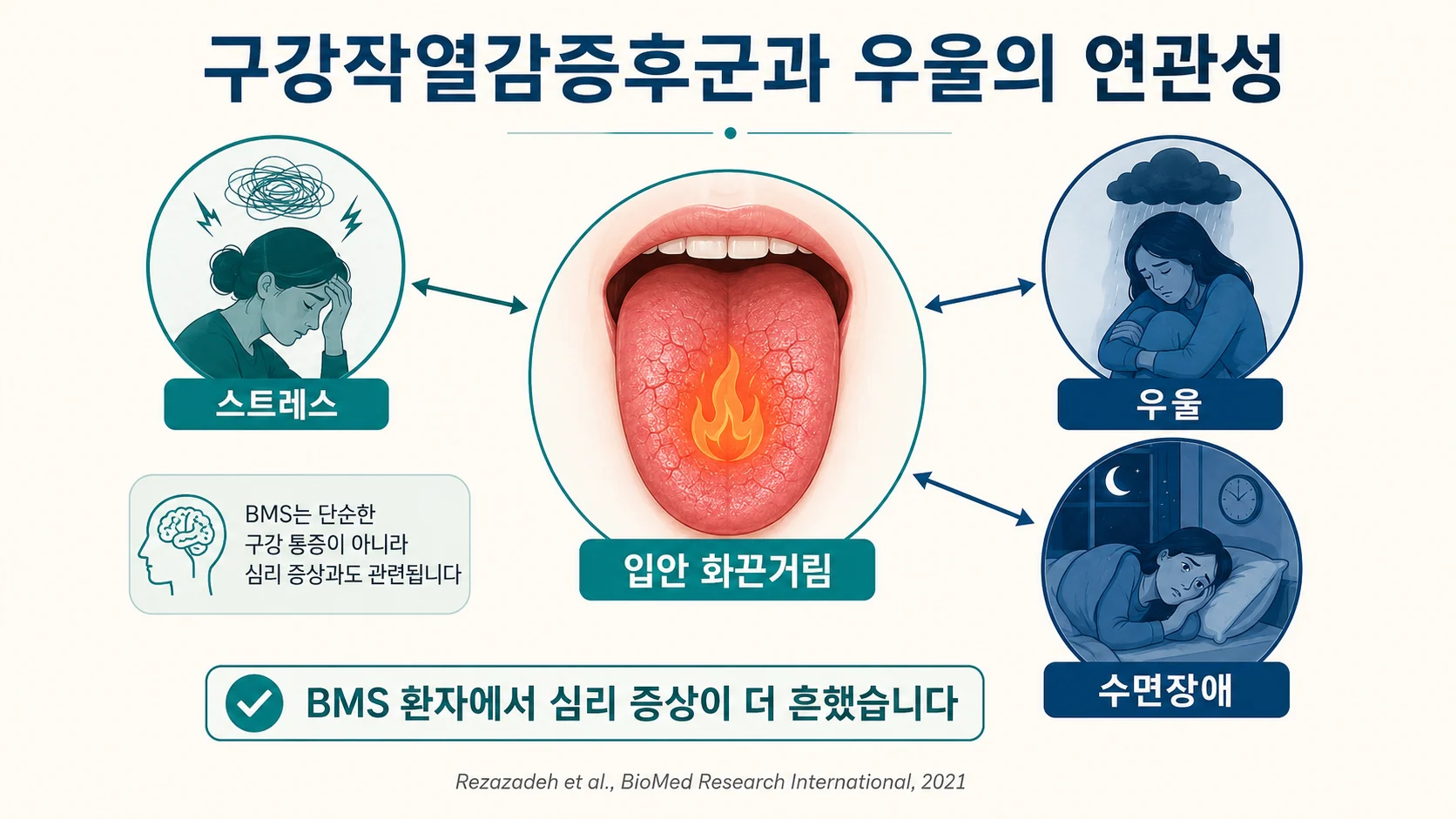구강작열감증후군과 우울·스트레스·수면장애의 연관성을 정리한 그림