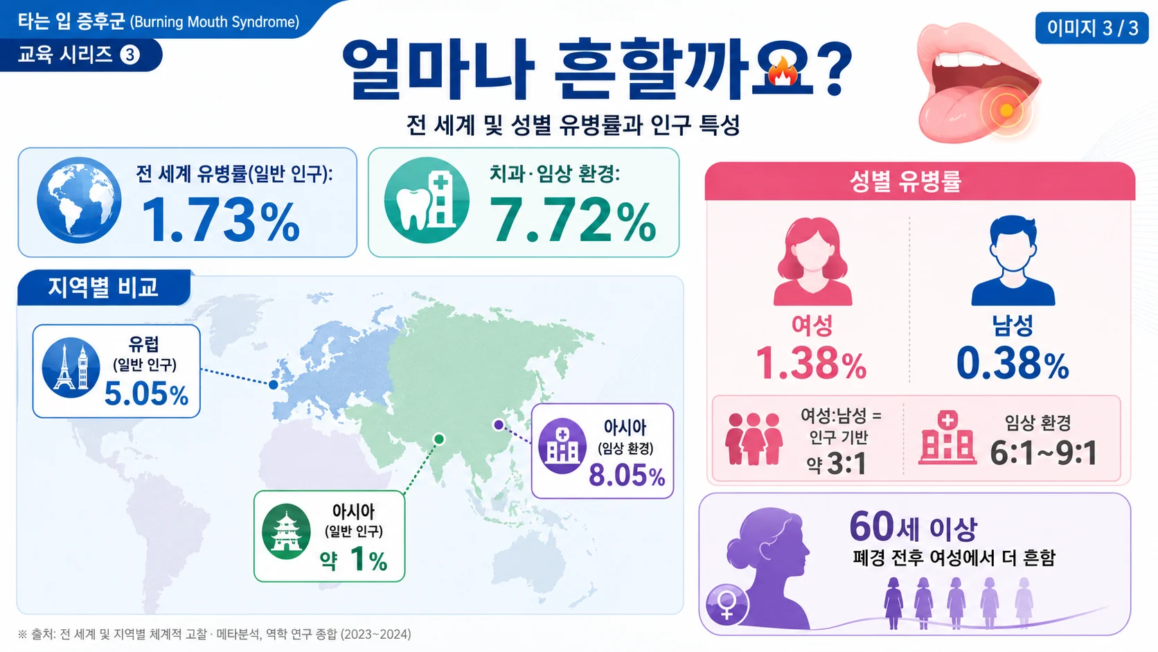 구강작열감증후군 유병률 — 일반 1.73% vs 임상 7.72%, 성별·연령 분포