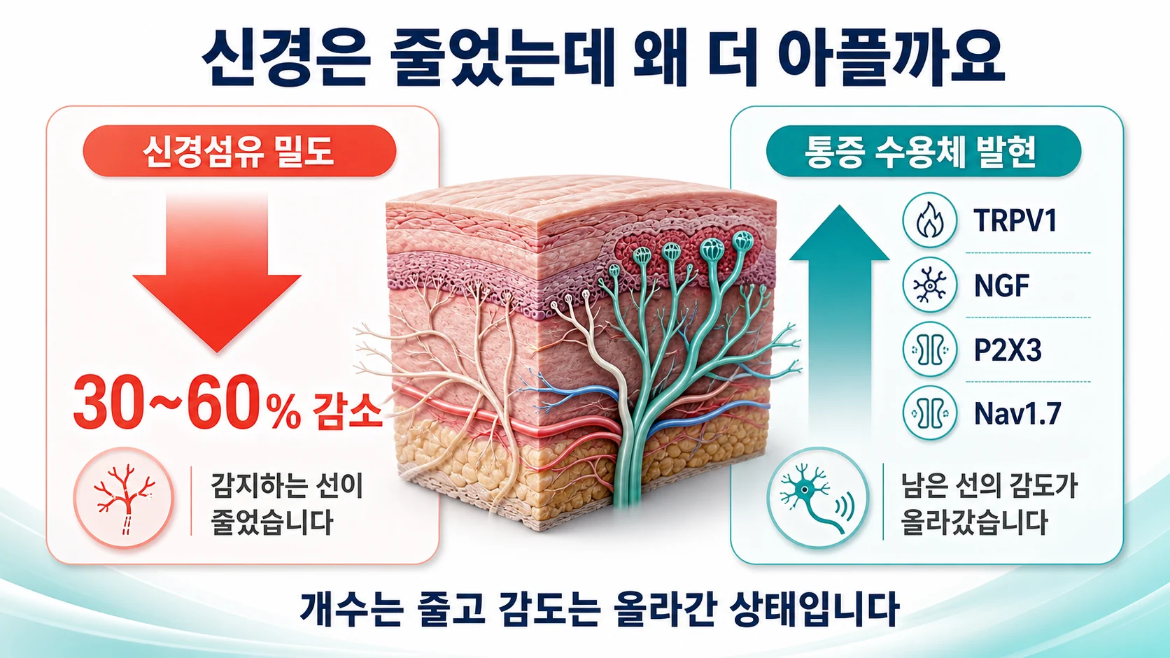 구강작열감증후군에서 신경섬유 밀도는 30～60% 줄어드는데 TRPV1과 NGF, P2X3 같은 통증 수용체 발현은 오히려 늘어나는 대비를 보여주는 그림
