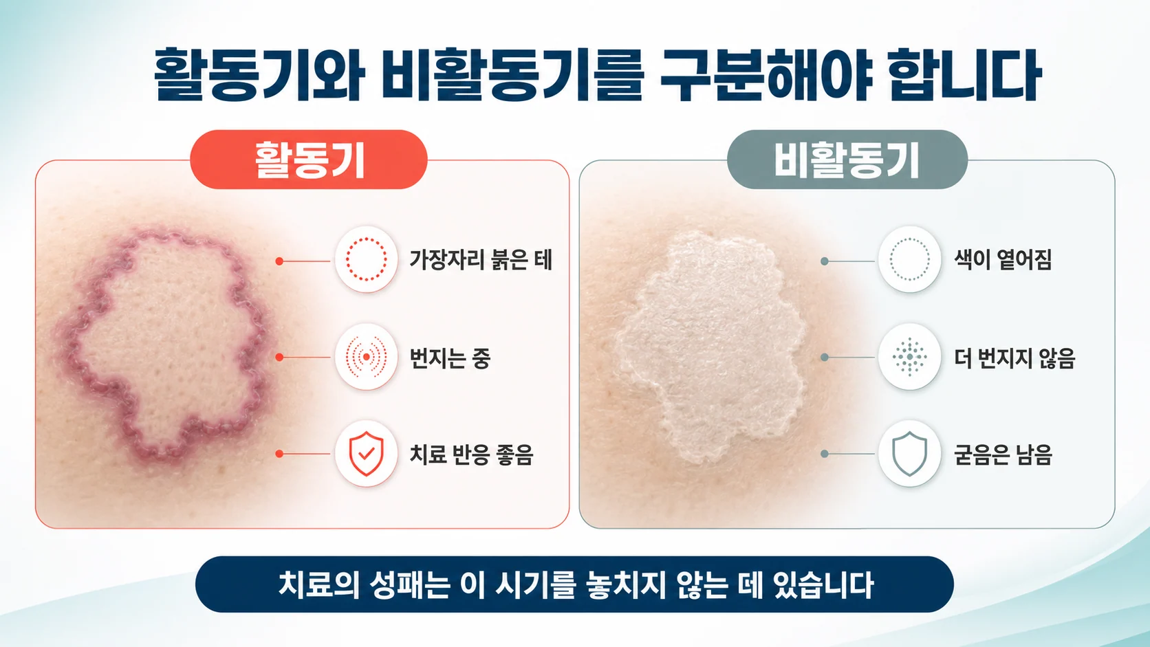활동기와 비활동기를 구분하는 기준을 비교한 이미지