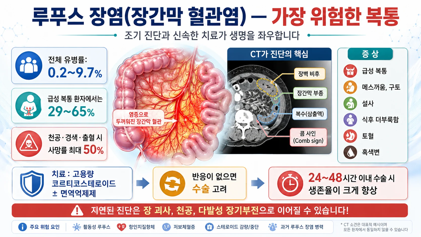 루푸스 장염 — 급성 복통 환자 29~65%, 사망률 최대 50%, 24~48시간 내 수술이 관건