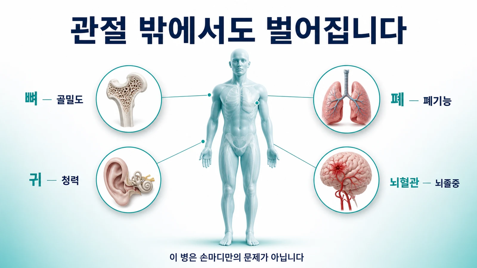 사람 몸을 중심으로 뼈의 골밀도와 폐의 폐기능, 귀의 청력, 뇌혈관의 뇌졸중까지 관절 밖에서 벌어지는 문제를 표시한 이미지