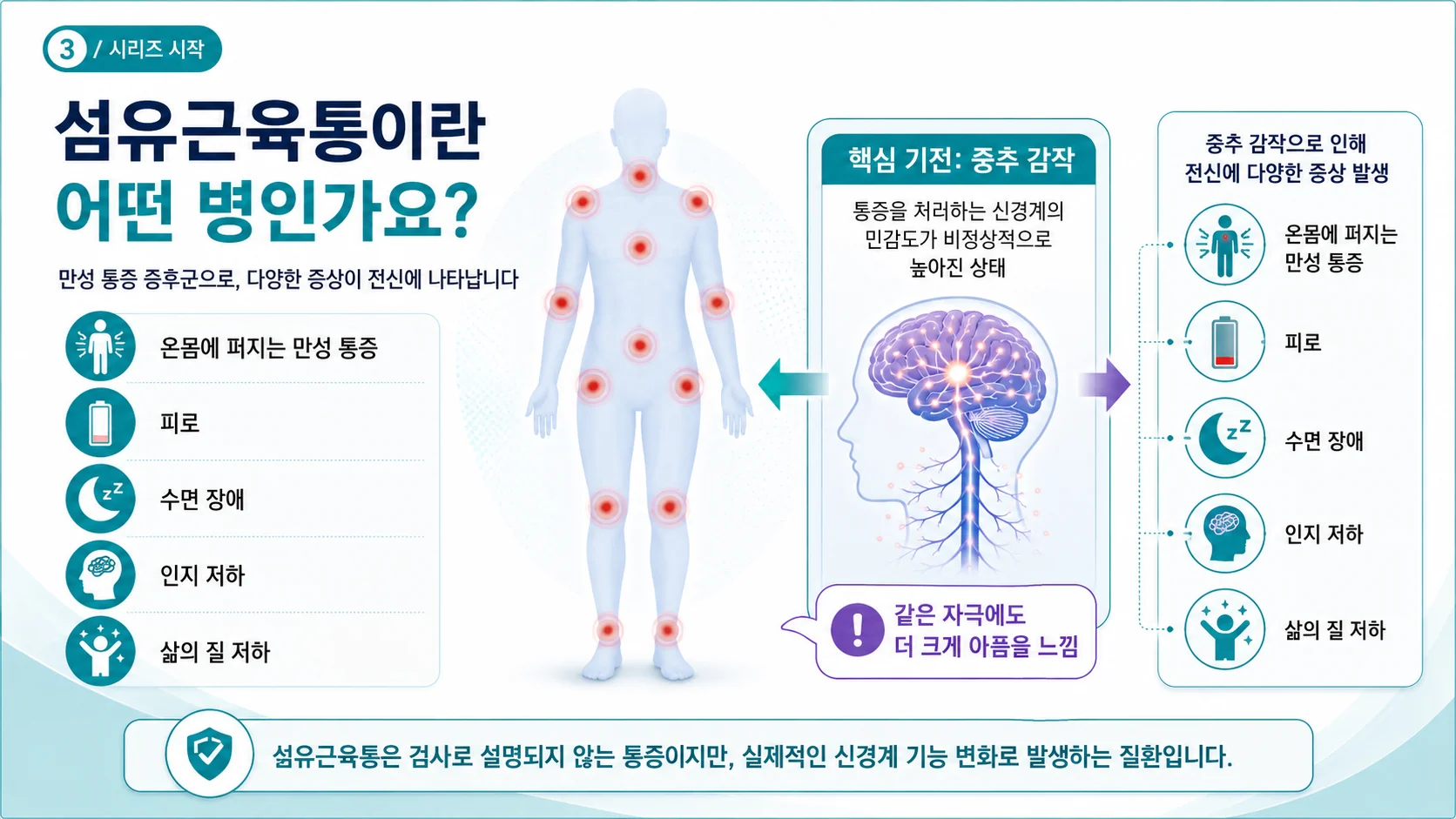 섬유근육통이란 — 신경계 통증 민감화가 핵심인 만성 통증 증후군