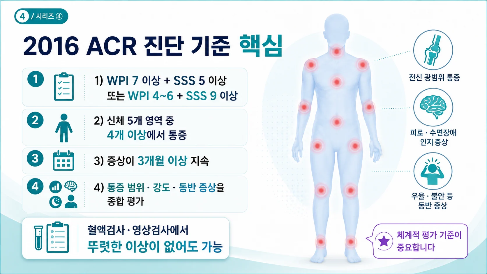2016 ACR 섬유근육통 진단 기준 — WPI·SSS 핵심