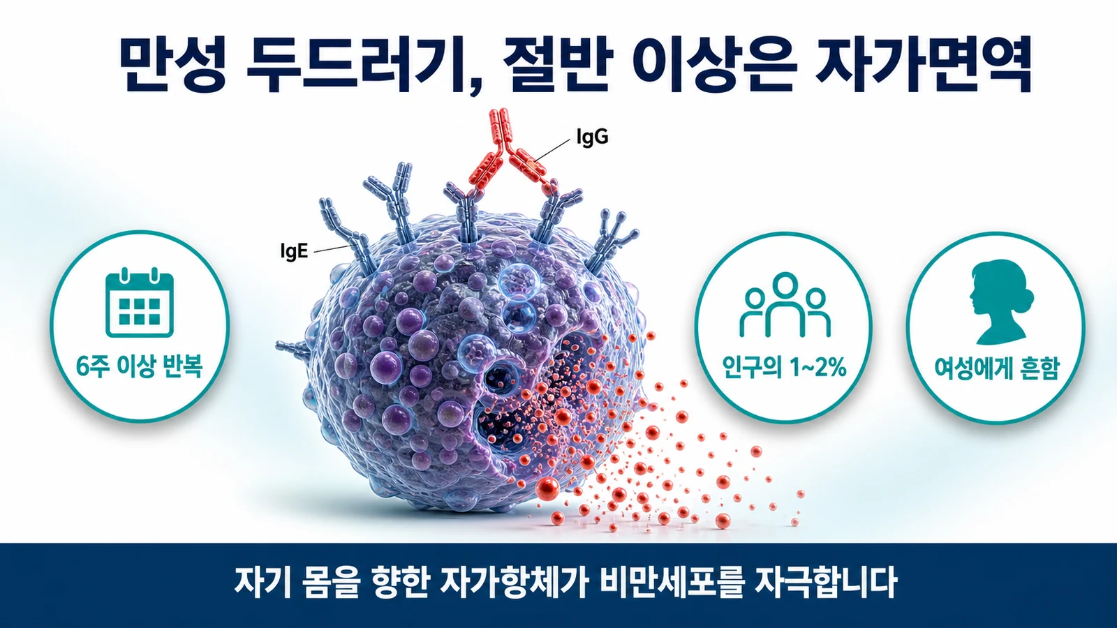 만성 자발성 두드러기의 자가면역 기전과 동반 자가면역질환을 설명하는 인포그래픽