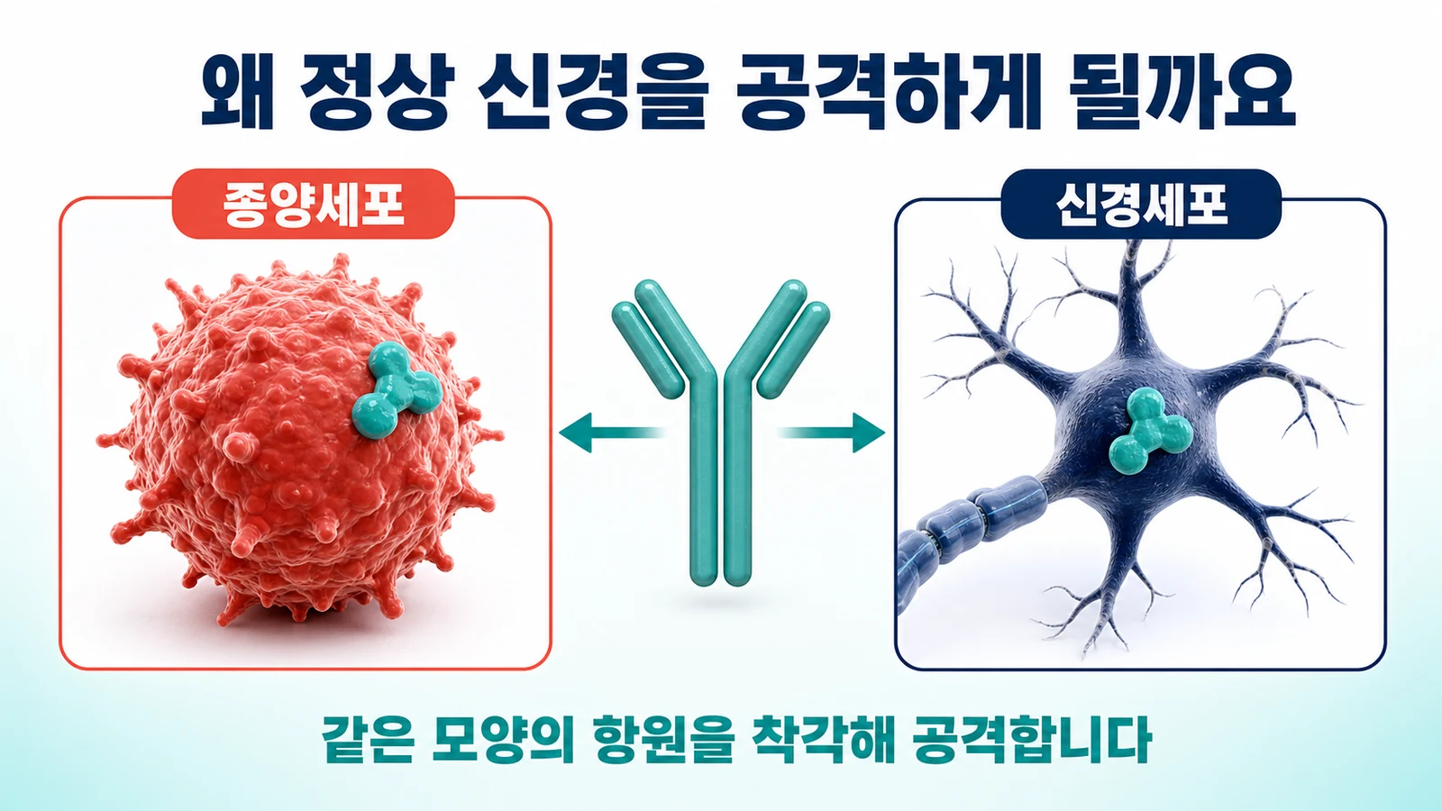 종양세포와 신경세포가 같은 항원을 공유해 면역 공격이 겹치는 과정을 보여주는 그림