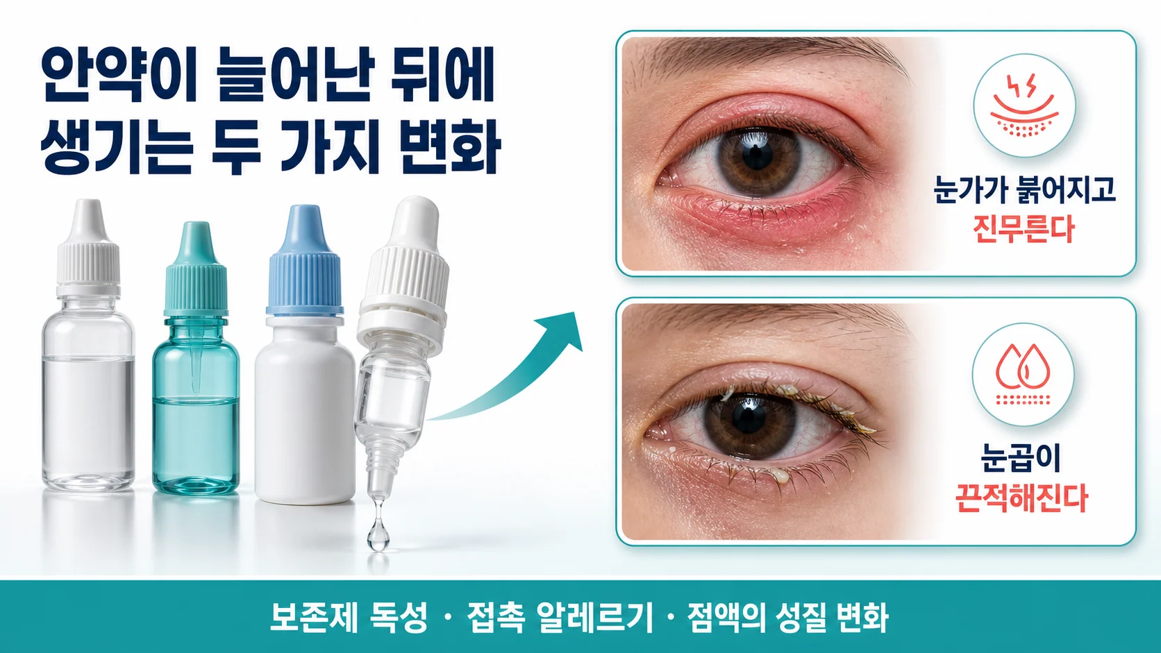 여러 안약 사용 후 눈가가 진무르고 끈적한 눈곱이 생기는 과정 개념도