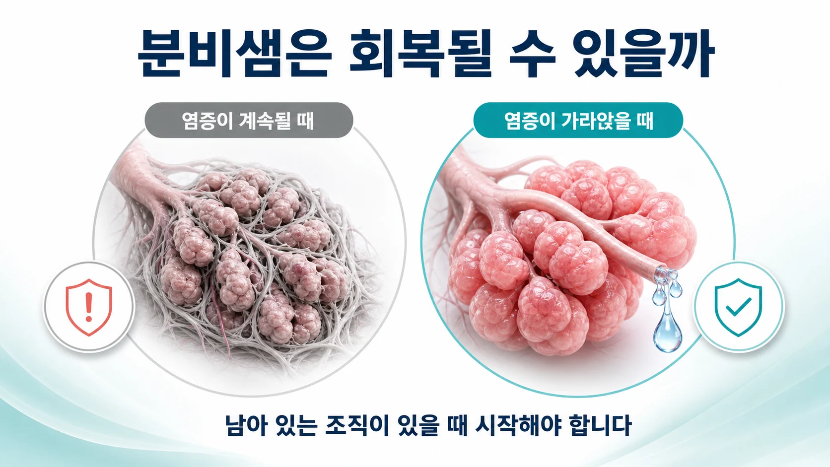 염증이 계속될 때와 가라앉을 때 분비샘의 상태를 비교한 이미지