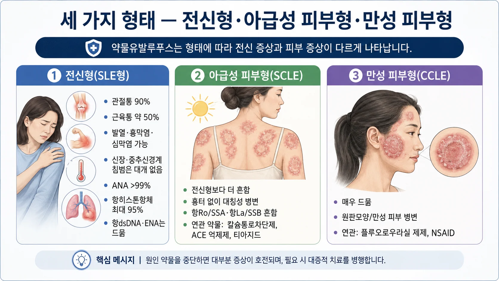 세 가지 형태 — 전신형(SLE)·아급성 피부형(SCLE)·만성 피부형(CCLE)