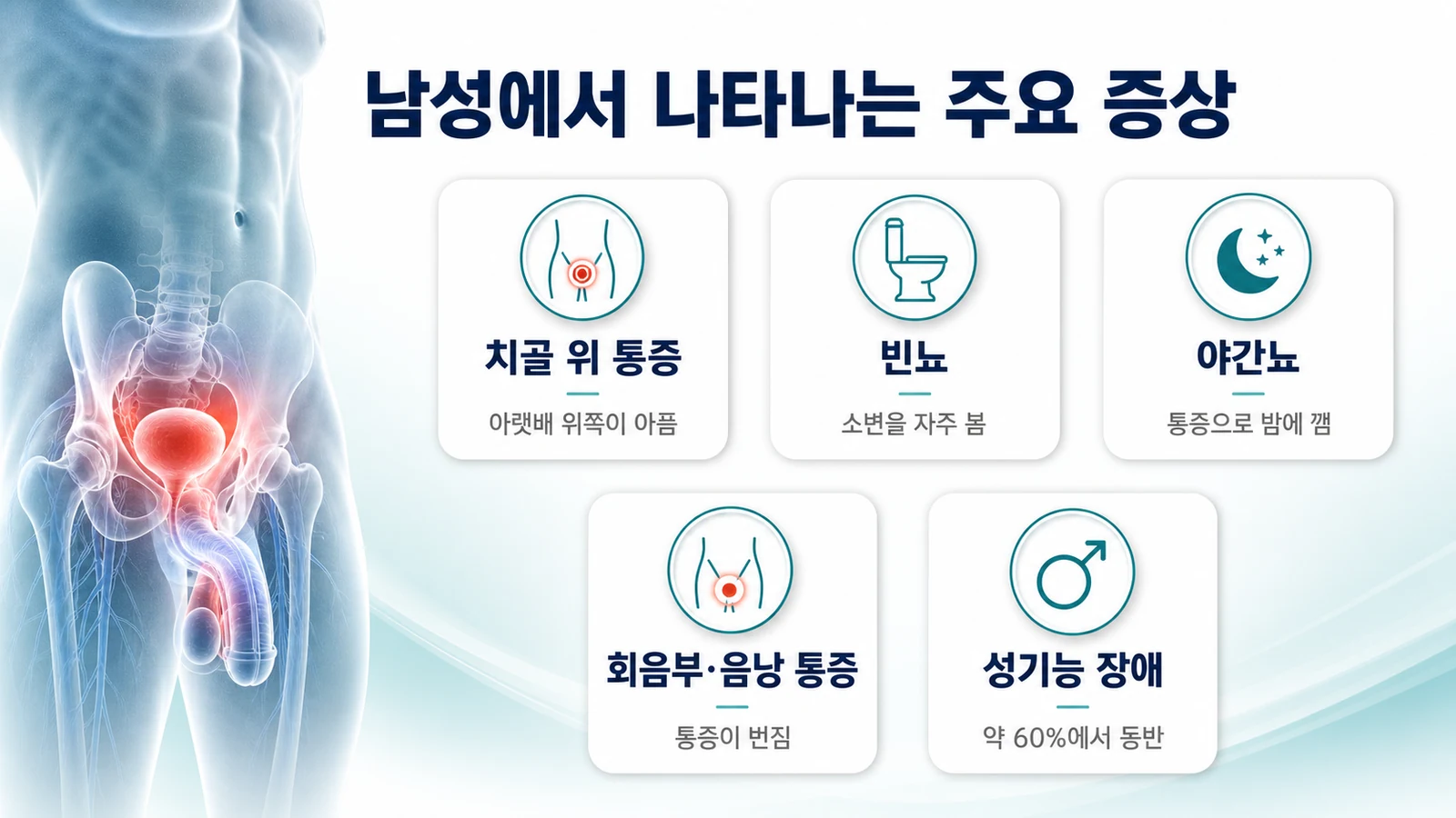 남성 간질성 방광염의 주요 증상을 정리한 인포그래픽