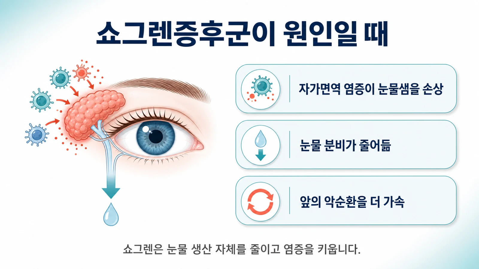 쇼그렌증후군이 원인일 때