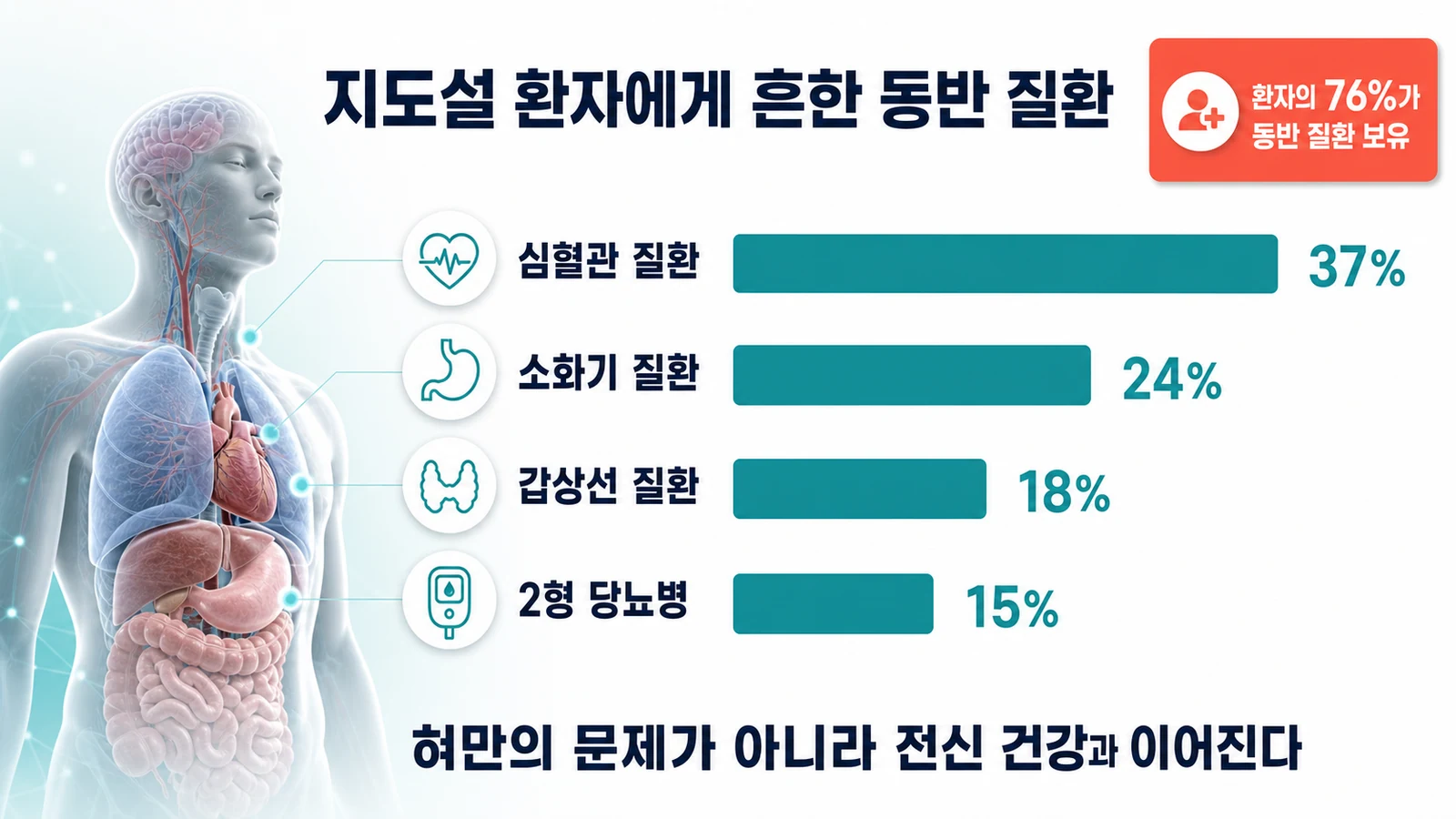 지도설 환자의 동반 질환 — 심혈관 37%, 소화기 24%, 갑상선 18%, 2형 당뇨병 15%를 보여주는 인포그래픽