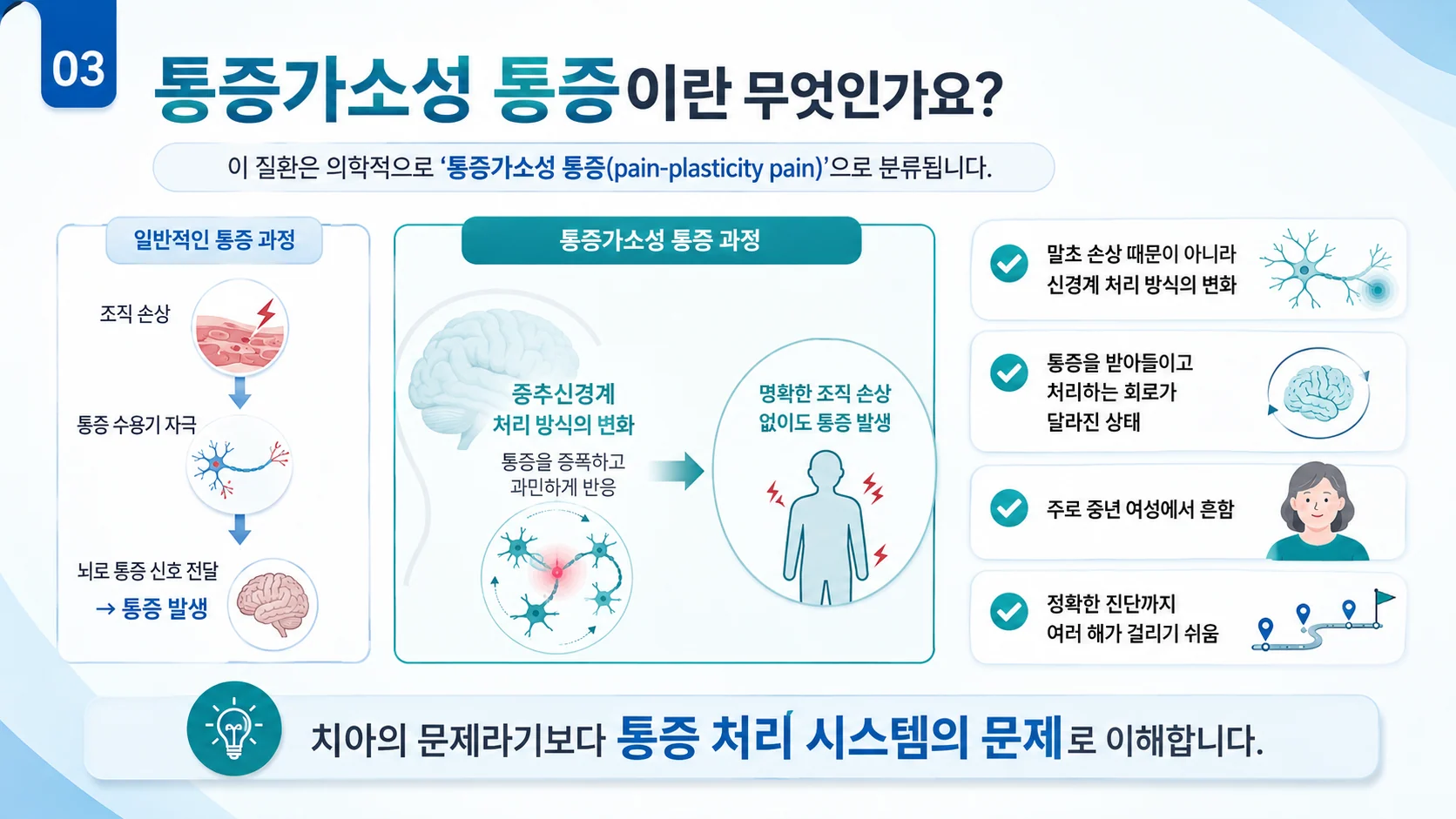 통증가소성 통증 개념 — 치아 자체보다 통증 처리 시스템의 문제로 이해