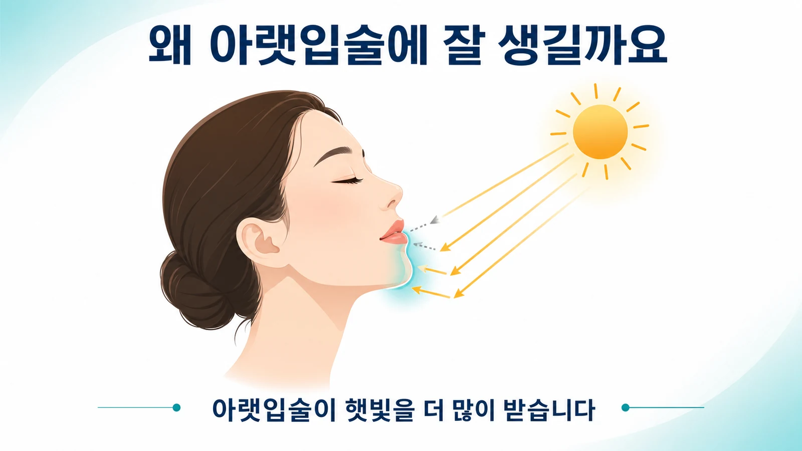 아랫입술이 햇빛을 더 많이 받아 광선 입술염이 생기기 쉬움을 나타낸 그림