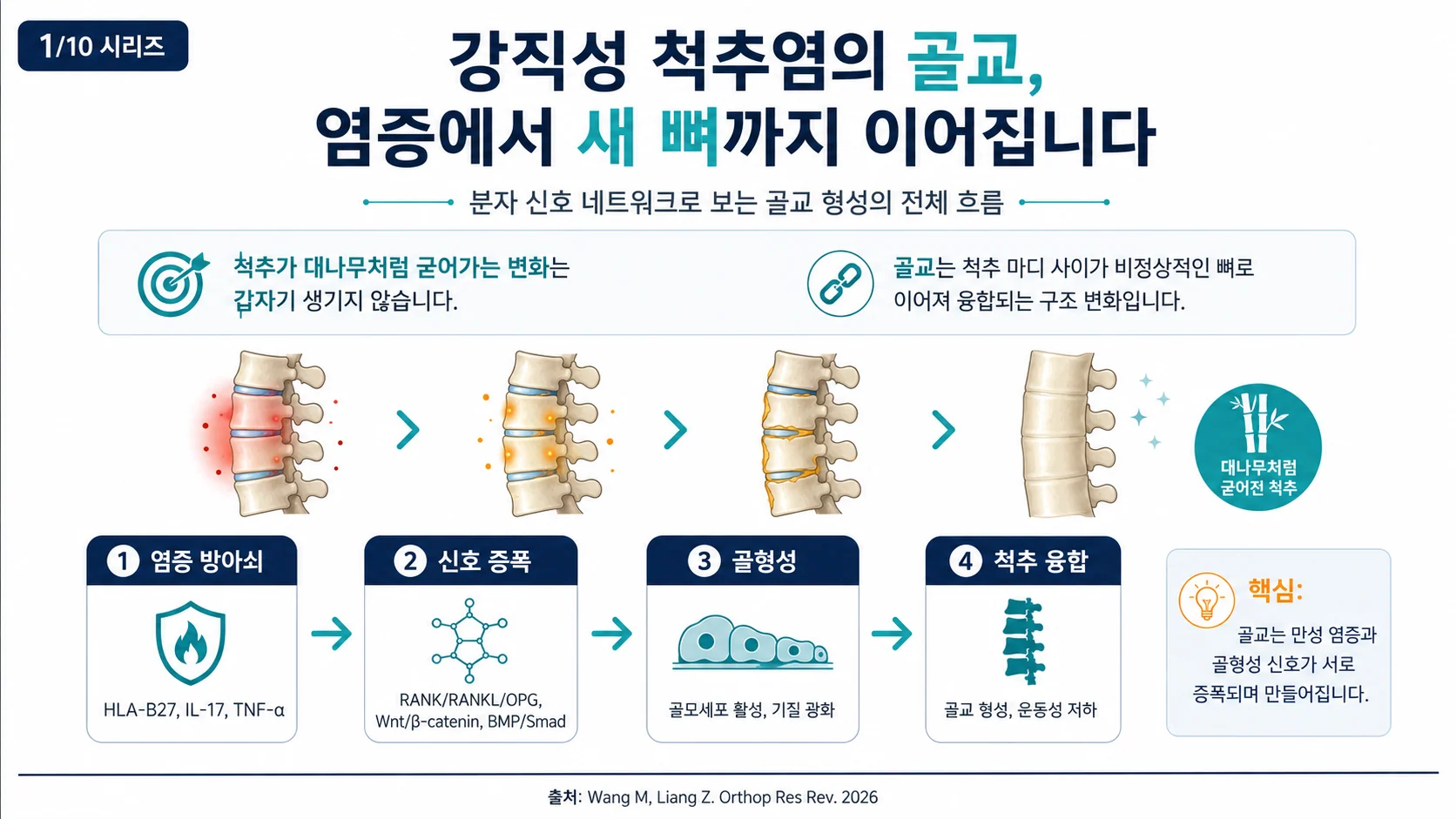 강직성 척추염의 골교(Bone Bridging) 형성 — 염증에서 새 뼈까지, 신호 네트워크의 전 과정