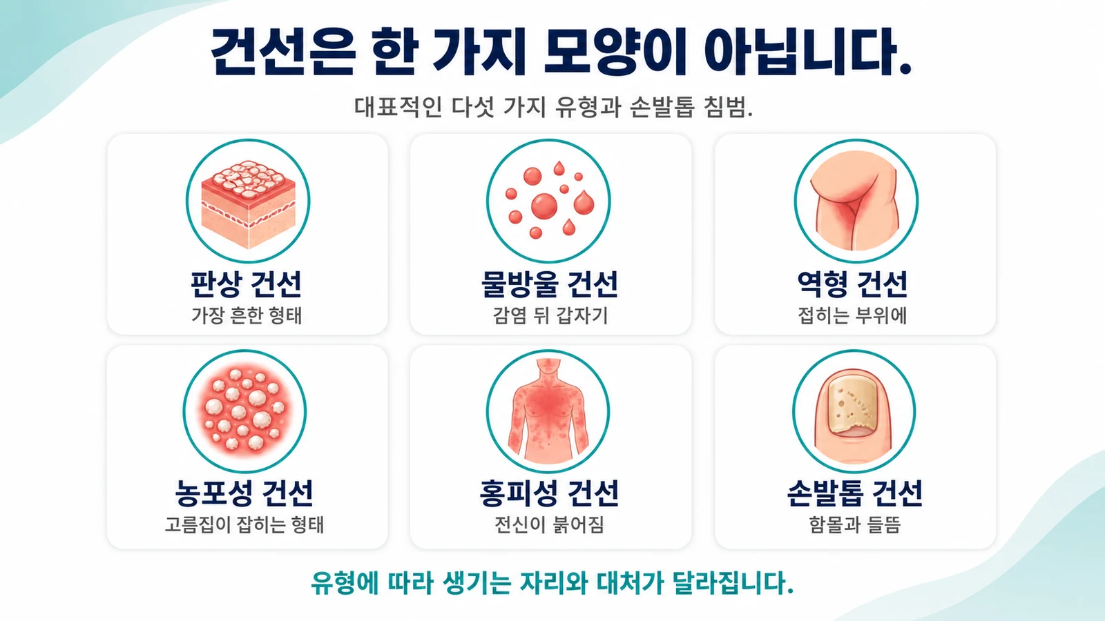 건선의 종류와 구분법 — 판상·물방울·역형·농포성·홍피성 | 인천 건선 치료 한의원