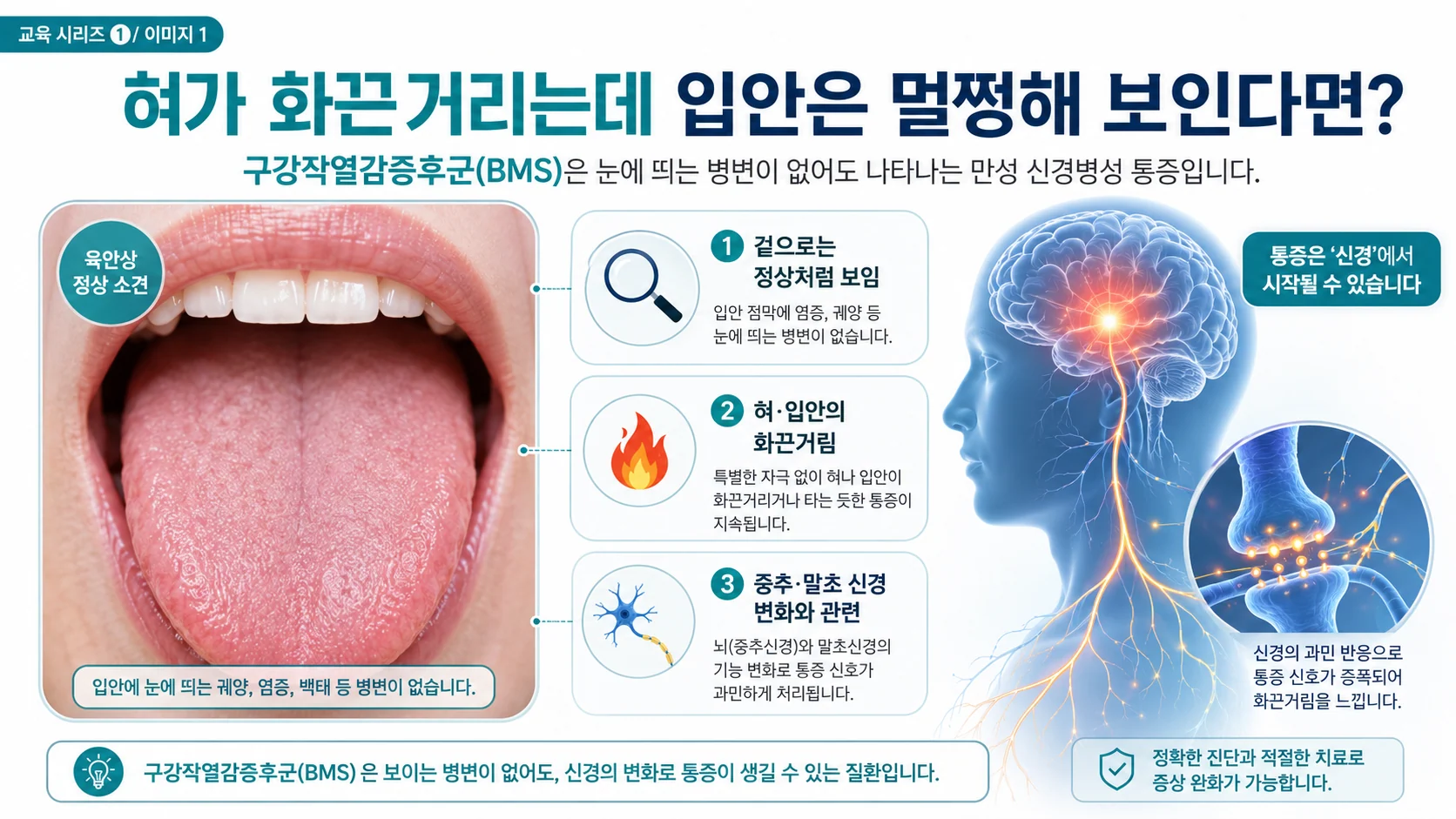 구강작열감증후군(BMS)의 병태생리와 진단 알고리즘 — 2025 최신 리뷰