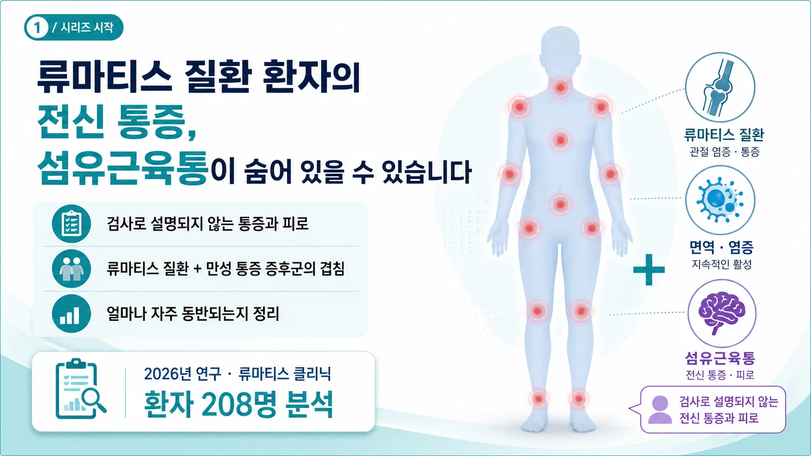 류마티스 질환 환자의 절반이 섬유근육통? 208명 연구로 본 유병률과 특징