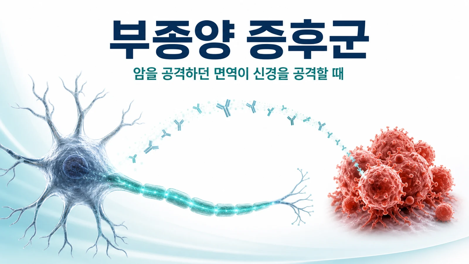 부종양 증후군 — 암과 싸우던 항체가 신경을 공격할 때