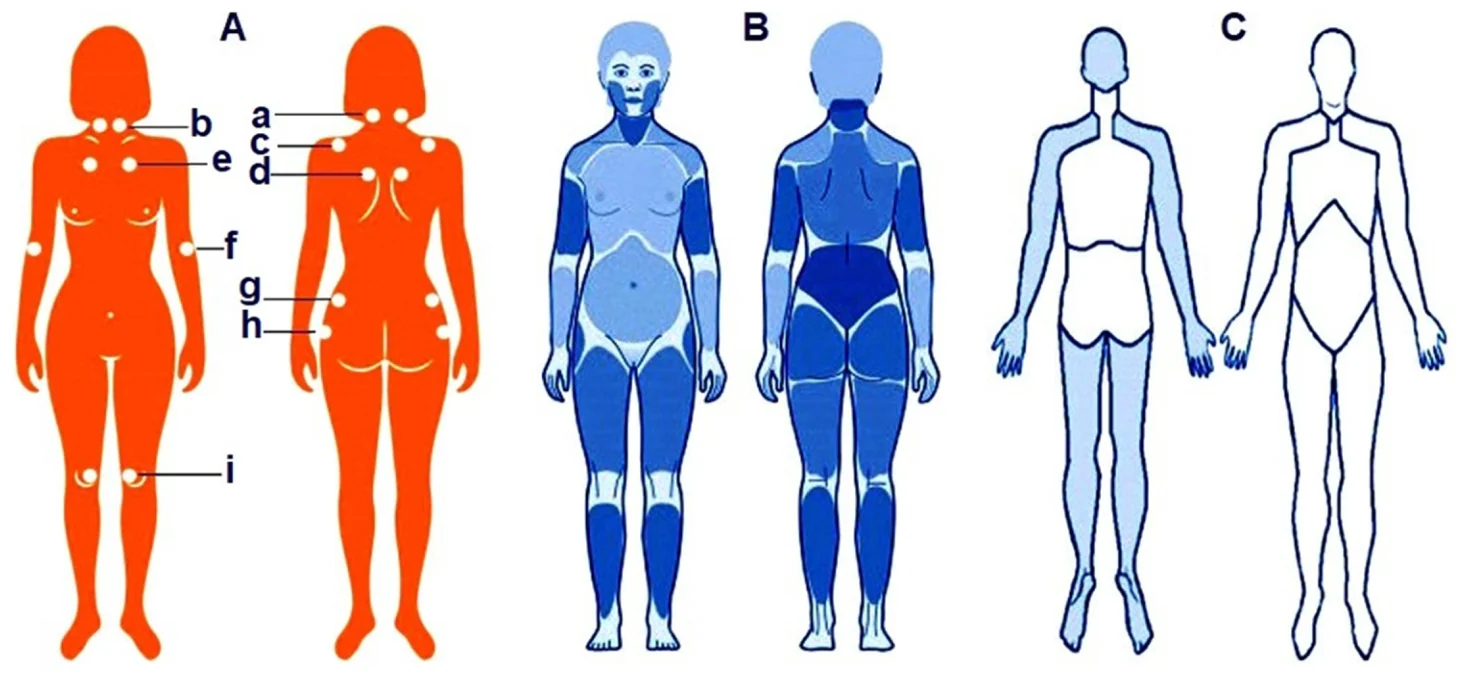 섬유근육통은 왜 아플까 — 중추감작과 말초감작으로 본 통증의 원인