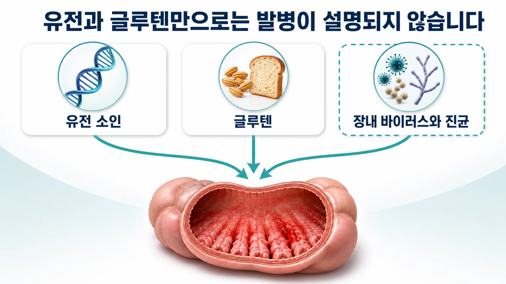 셀리악병, 유전과 글루텐만으로 설명되지 않을 때