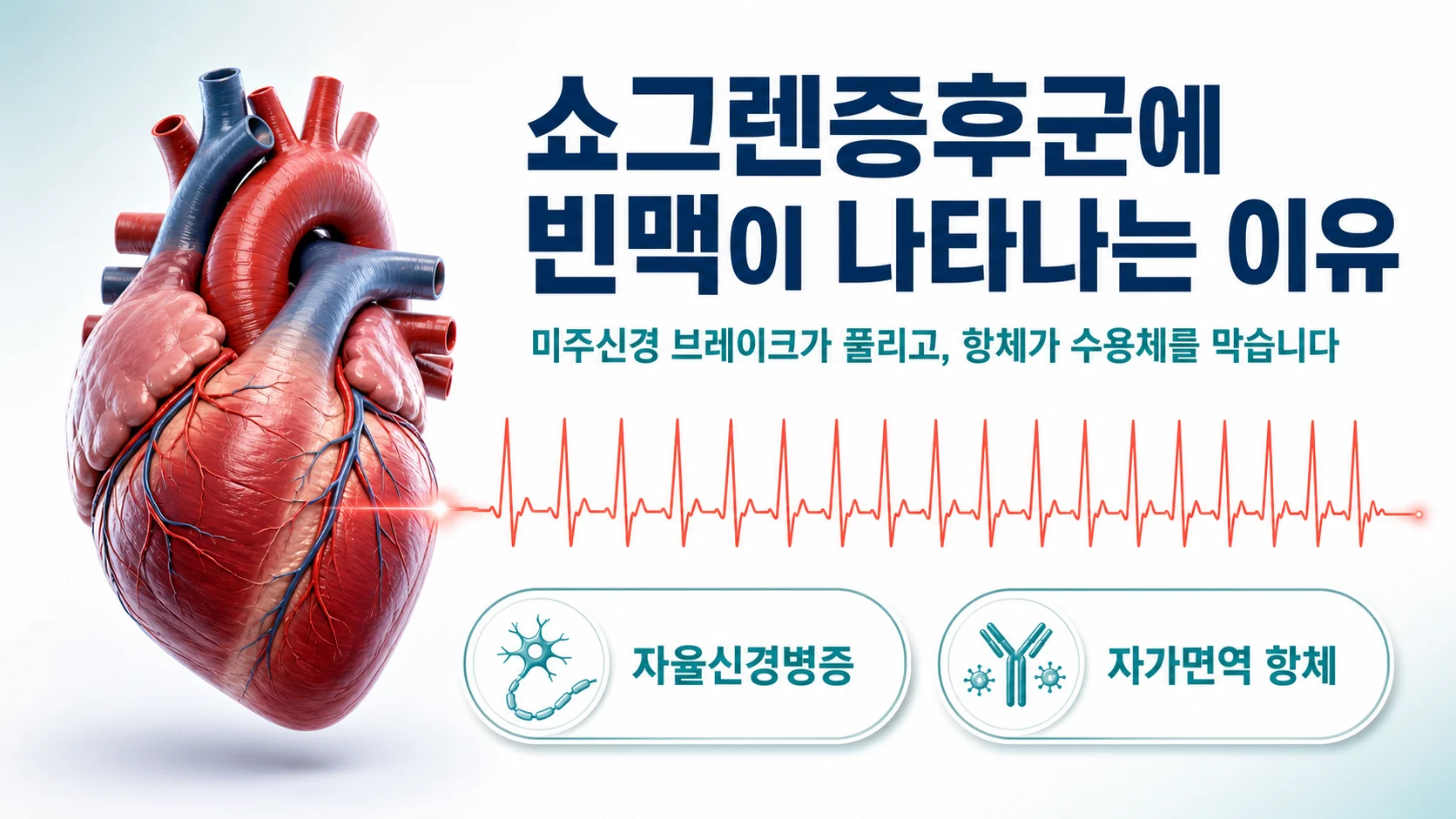 쇼그렌증후군에 맥박이 빨리 뛰는 빈맥이 나타나는 이유
