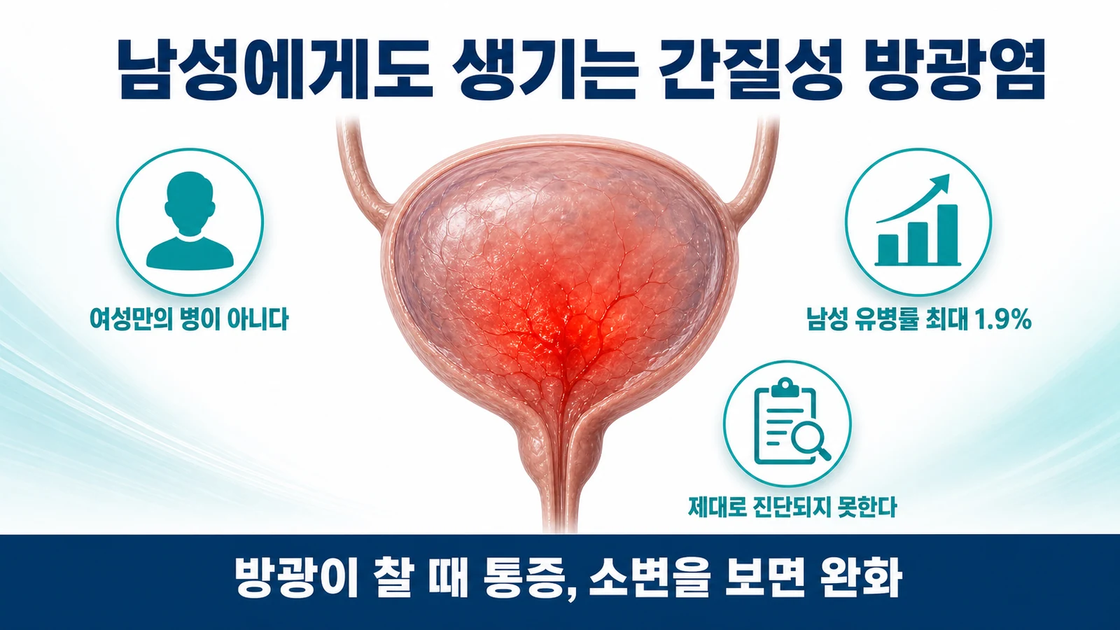 인천 간질성 방광염 치료 — 남성에게 발생한 경우의 특징