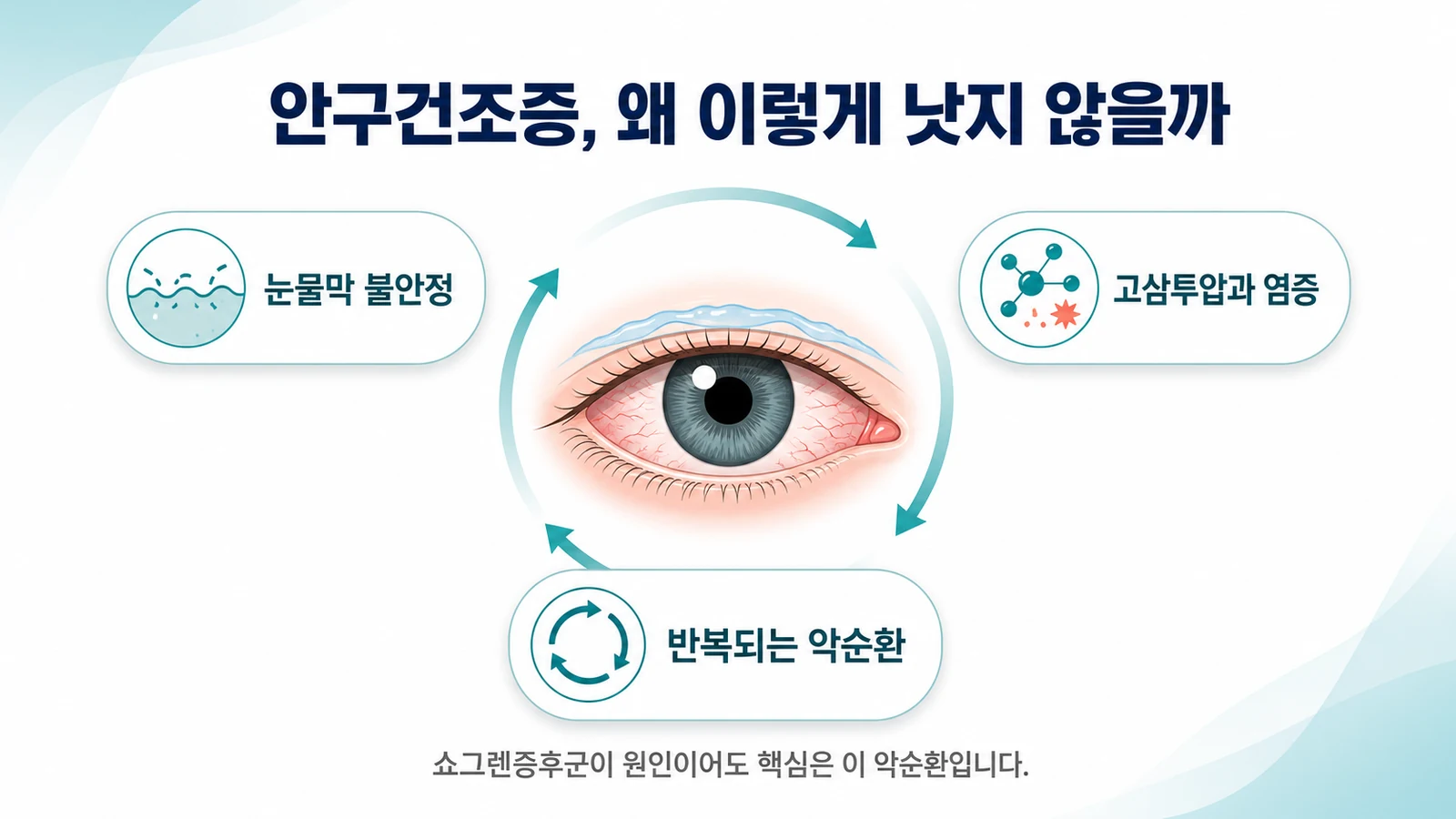 인천 안구건조증 치료 한의원 - 쇼그렌증후군이 원인이라도