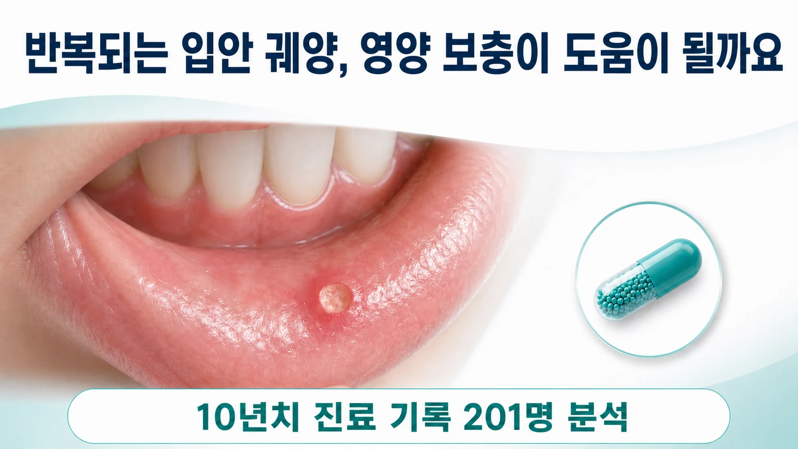 인천 재발성 아프타성 구내염 한의원 — 아연 복용이 도움이 될까